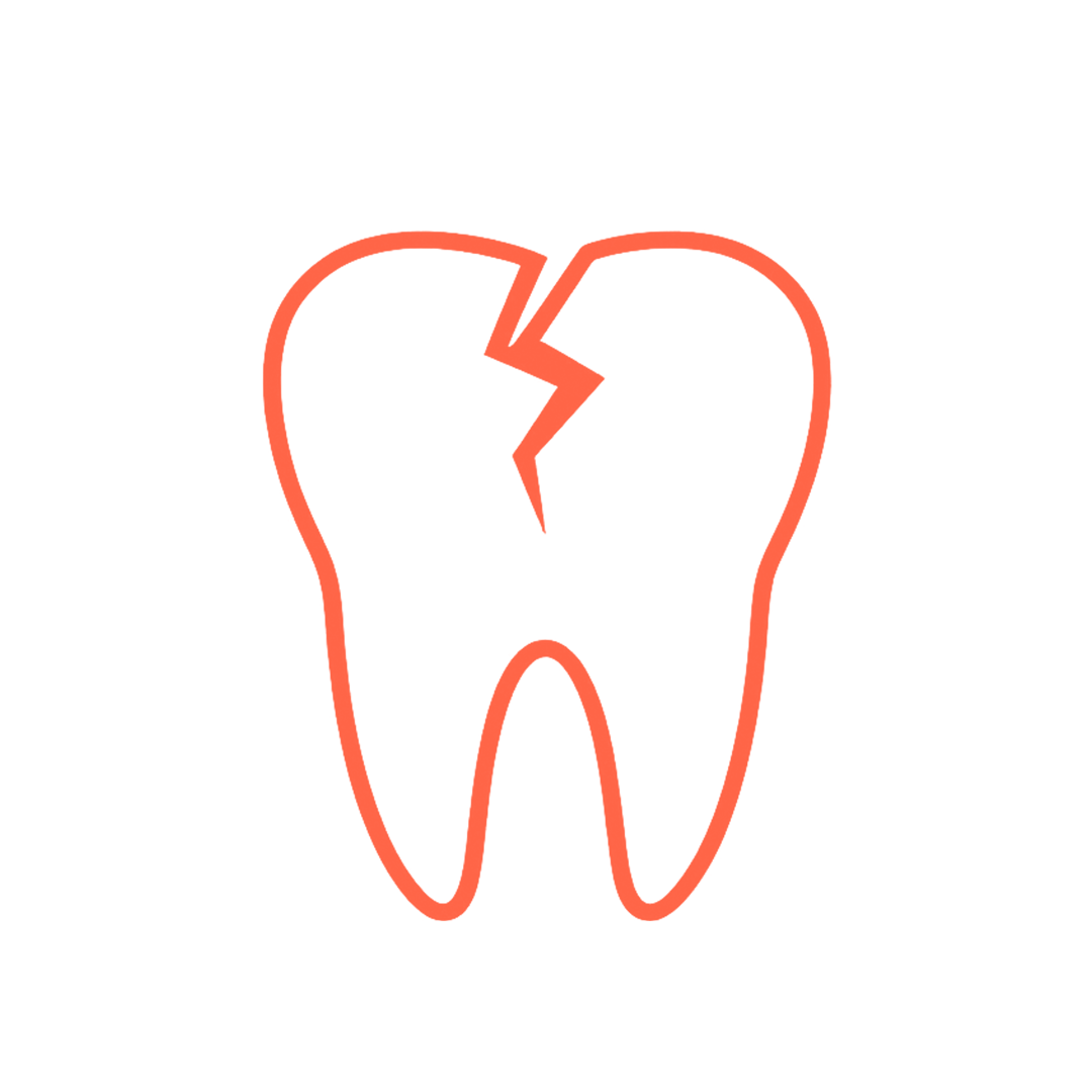 Broken or Cracked Tooth Repair